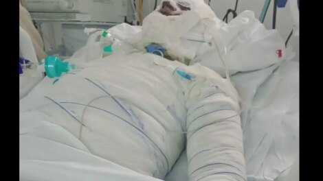 familia-de-homem-que-teve-70%-do-corpo-queimado-por-vinganca-pede-justica