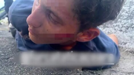 tentativa-de-assalto:-ladrao-tenta-roubar-policial-civil-em-fortaleza-e-acaba-baleado