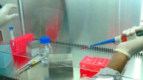 municipio-de-baturite-tem-mais-de-400-casos-de-febre-oropouche-este-ano