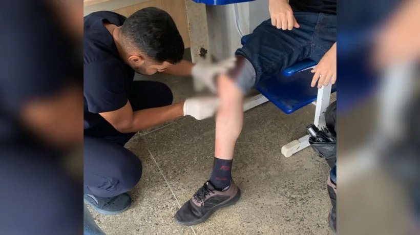 estudante-da-ufc-e-esfaqueado-em-tentativa-de-assalto-proximo-ao-campus-do-porangabucu