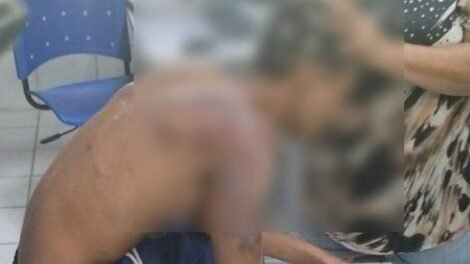 adolescente-e-sequestrado-de-escola,-torturado-e-tem-cabelo-cortado-por-criminosos-em-fortaleza