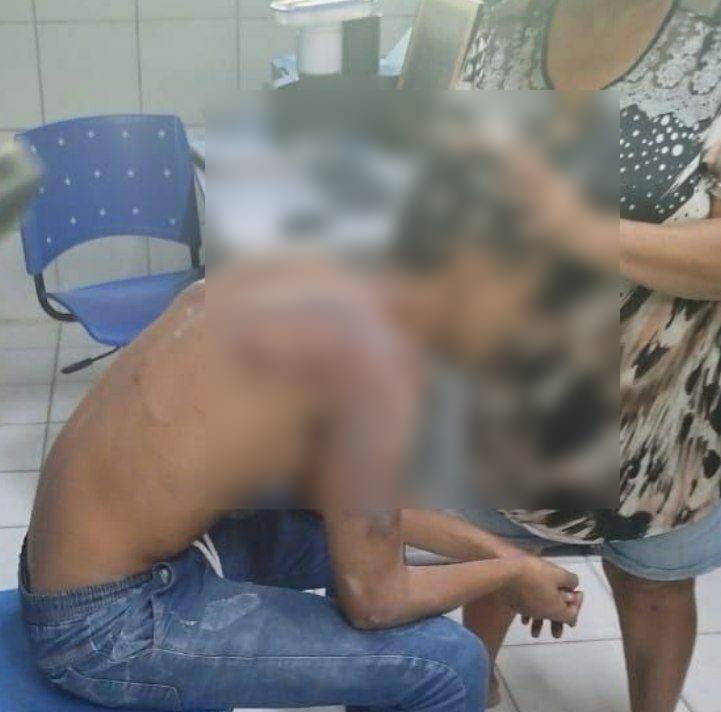 adolescente-e-sequestrado-de-escola,-torturado-e-tem-cabelo-cortado-por-criminosos-em-fortaleza
