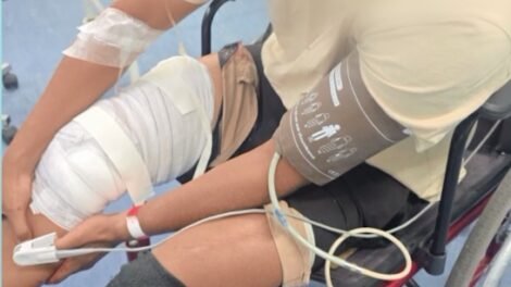 criminosos-passam-de-moto-e-atiram-em-jovem-que-jogava-bola-na-frente-de-casa,-em-fortaleza