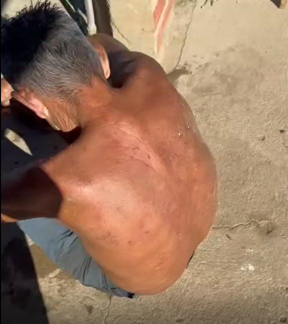 policial-militar-resgata-idoso-atacado-por-abelhas-no-interior-do-ceara