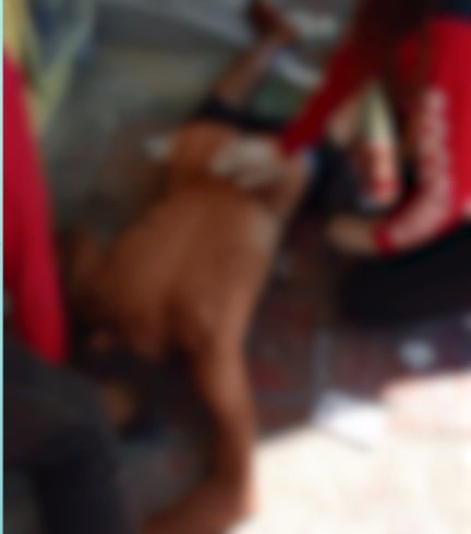 homem-em-situacao-de-rua-e-baleado-nas-nadegas-apos-ser-abordado-por-motociclista-em-fortaleza