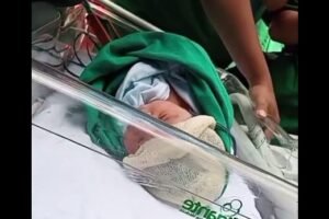 incendio-no-hospital-cesar-cals:-117-bebes-foram-transferidos-a-8-unidades-de-saude-de-fortaleza