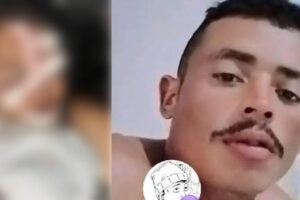 mulher-tem-fraturas-no-rosto-apos-ser-agredida-com-martelo-pelo-ex-companheiro-no-ceara