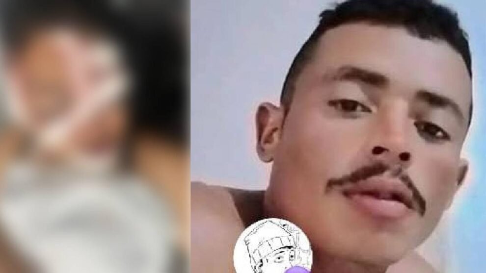 mulher-tem-fraturas-no-rosto-apos-ser-agredida-com-martelo-pelo-ex-companheiro-no-ceara