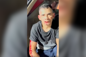 defesa-de-cearense-preso-por-atropelar-e-arrastar-mulher-pede-sigilo-em-processo-por-conta-de-ameacas