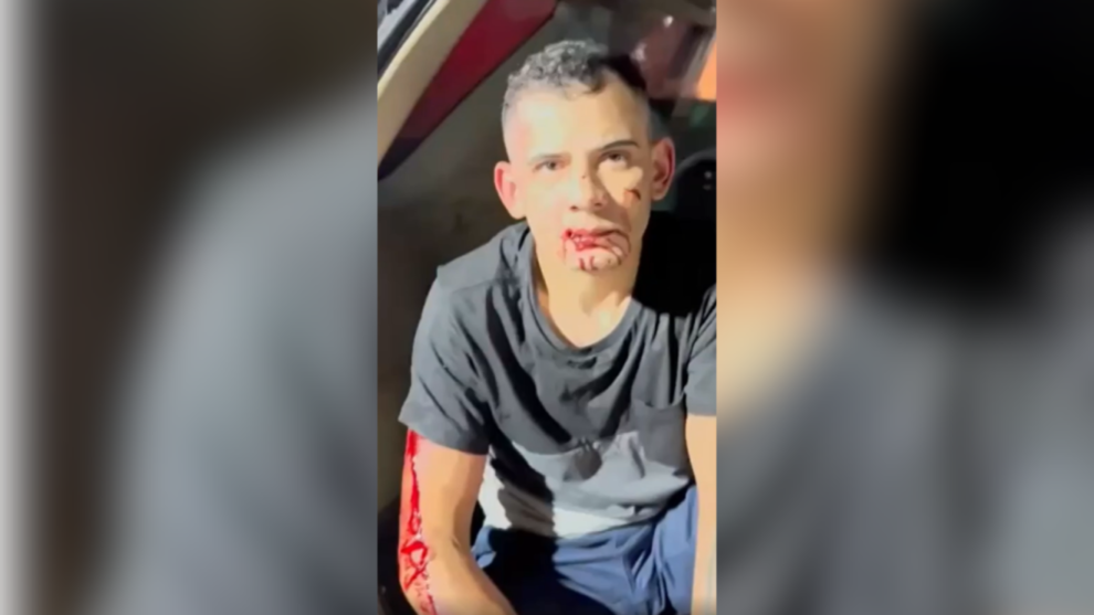 defesa-de-cearense-preso-por-atropelar-e-arrastar-mulher-pede-sigilo-em-processo-por-conta-de-ameacas