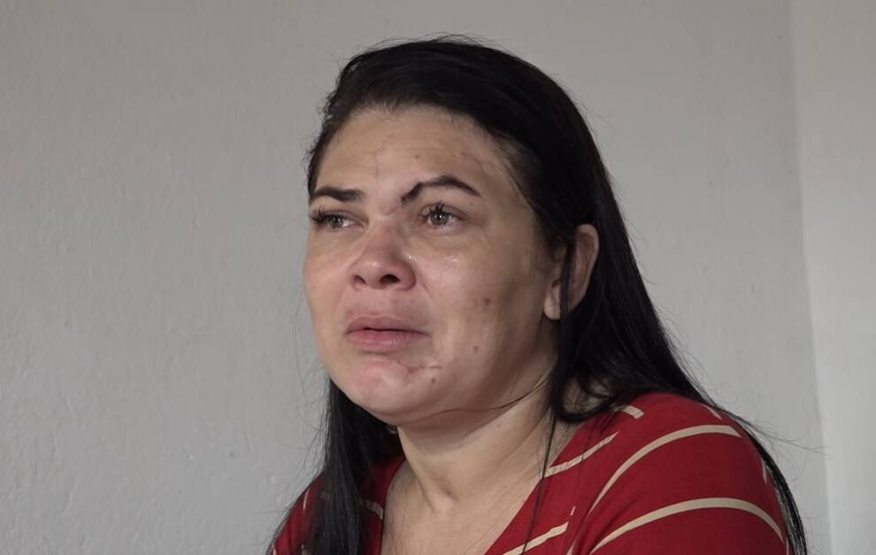 vitima-de-tentativa-de-feminicidio-no-ceara-quebra-silencio-e-relata-dificuldades-apos-sofrer-ataque-com-martelo