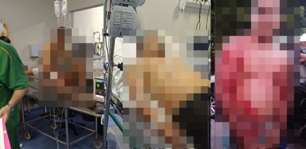 tentativa-de-chacina:-dois-homens-sao-mortos-em-ataque-a-tiros-na-lagoa-redonda,-em-fortaleza